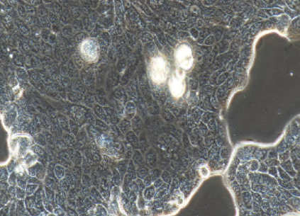 Calu-3 人肺腺癌细胞