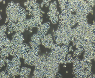 COLO320 人结直肠腺癌细胞