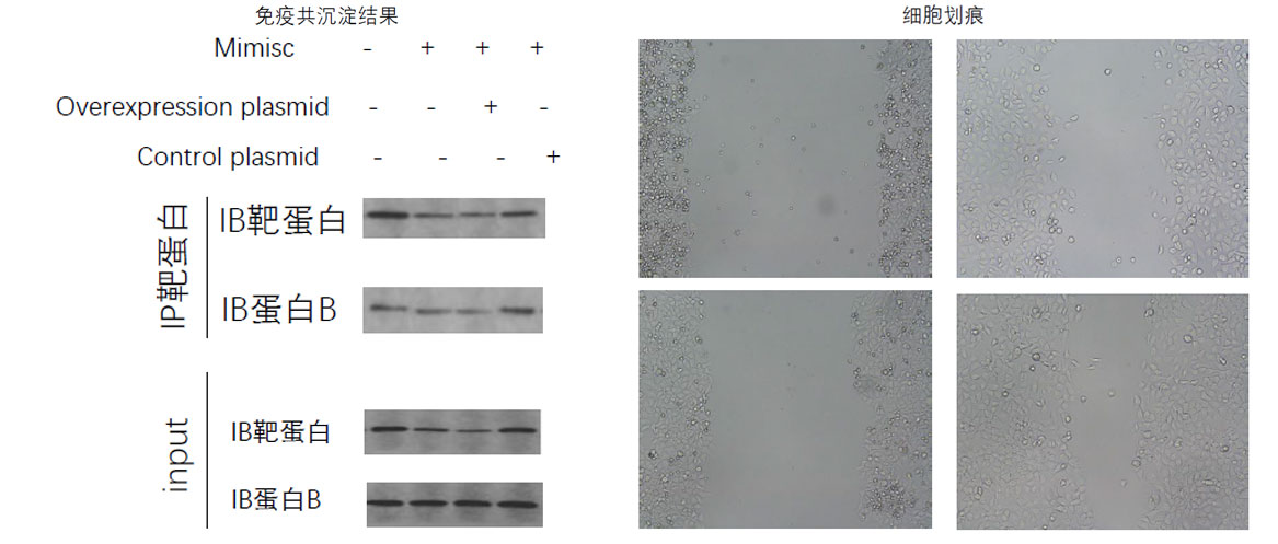 外泌体内miRNA-A对肺癌的影响及其机制研究