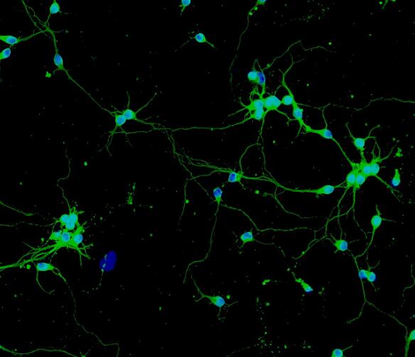 CD1小鼠海马趾神经元