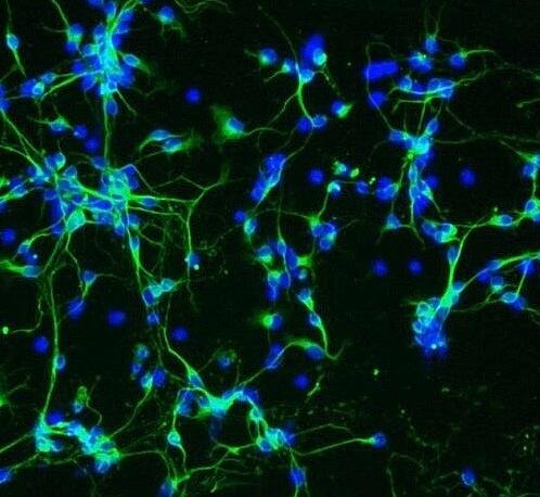CD1小鼠黑质神经元