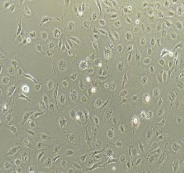 HUVEC+GFP 人脐静脉内皮细胞永生化+GFP